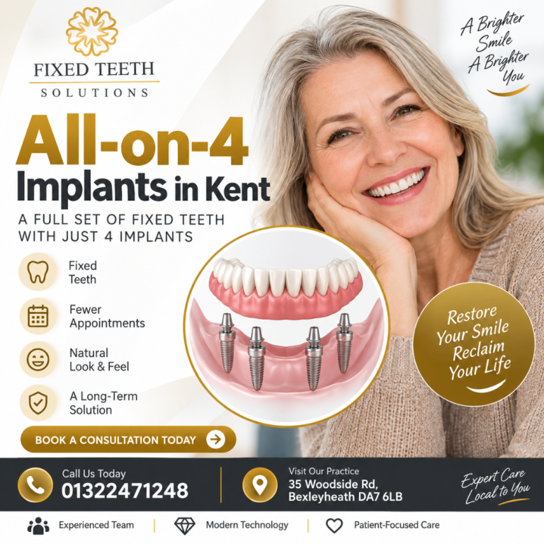 What Is the Cost of All-on-4 Implants in Kent?