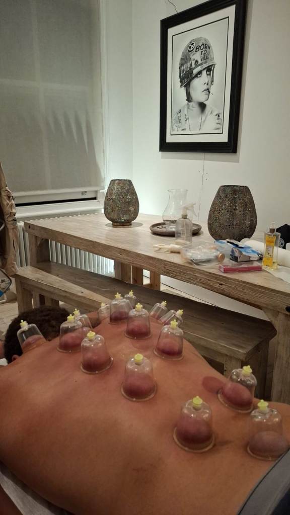 ite Advanced Hijama Therapy Training