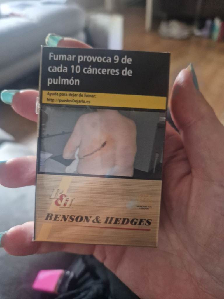 Box 20