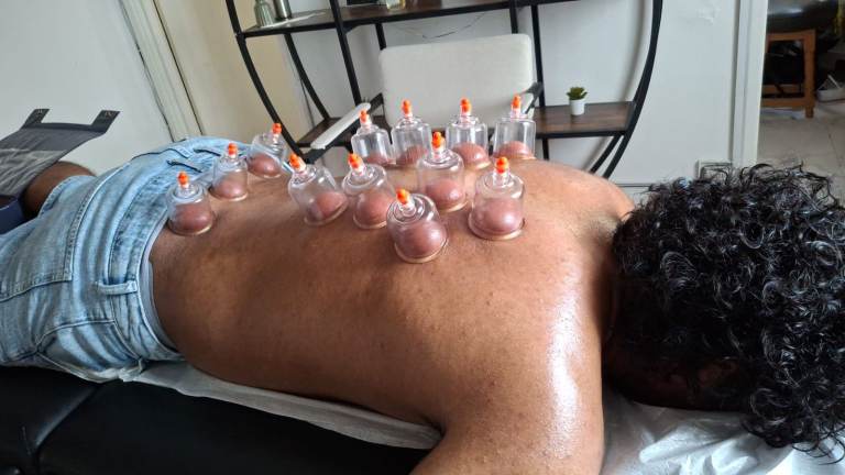 Certified Hijama Cupping Therapy Course – Learn Sunnah Healing in London
