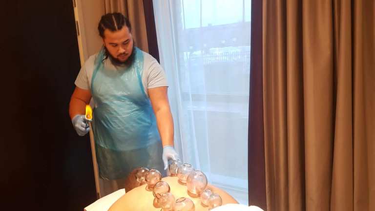 Fire Cupping Course London – Certified Training