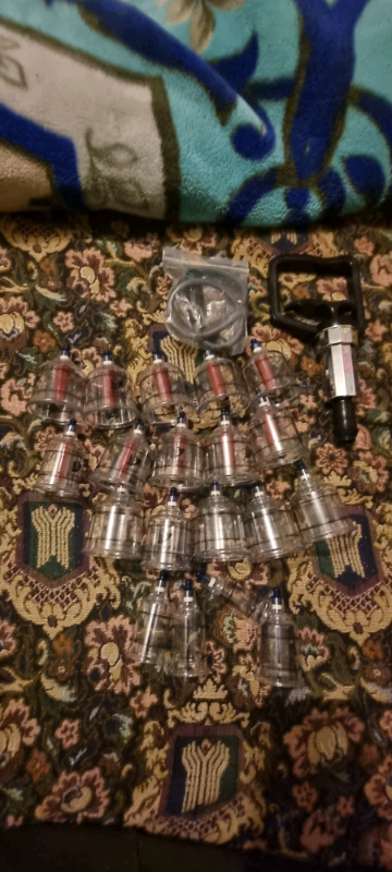 Hansol Professional Cupping Therapy Equipment Set with pumping handle 