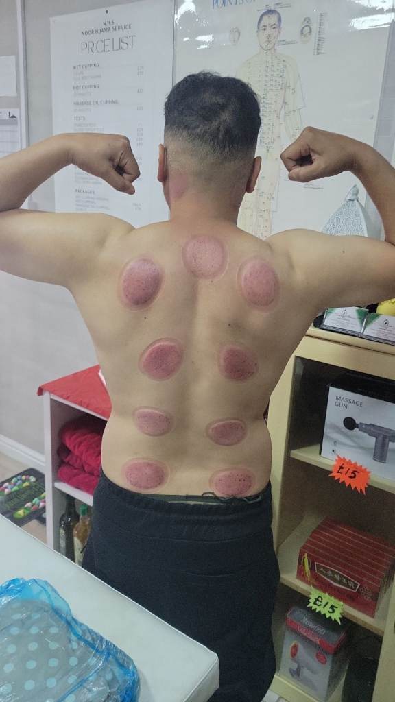 Massage, Deeptissue massage, Relaxation massage and Sports massage only £40