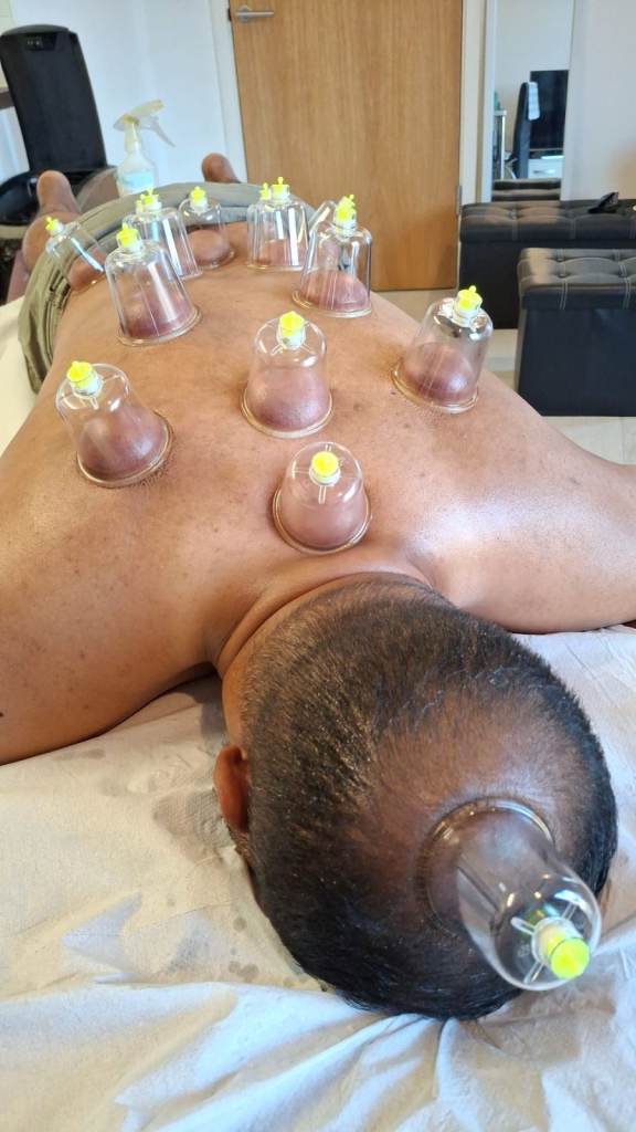 Islamic Hijama Wet Cupping Practitioner Course