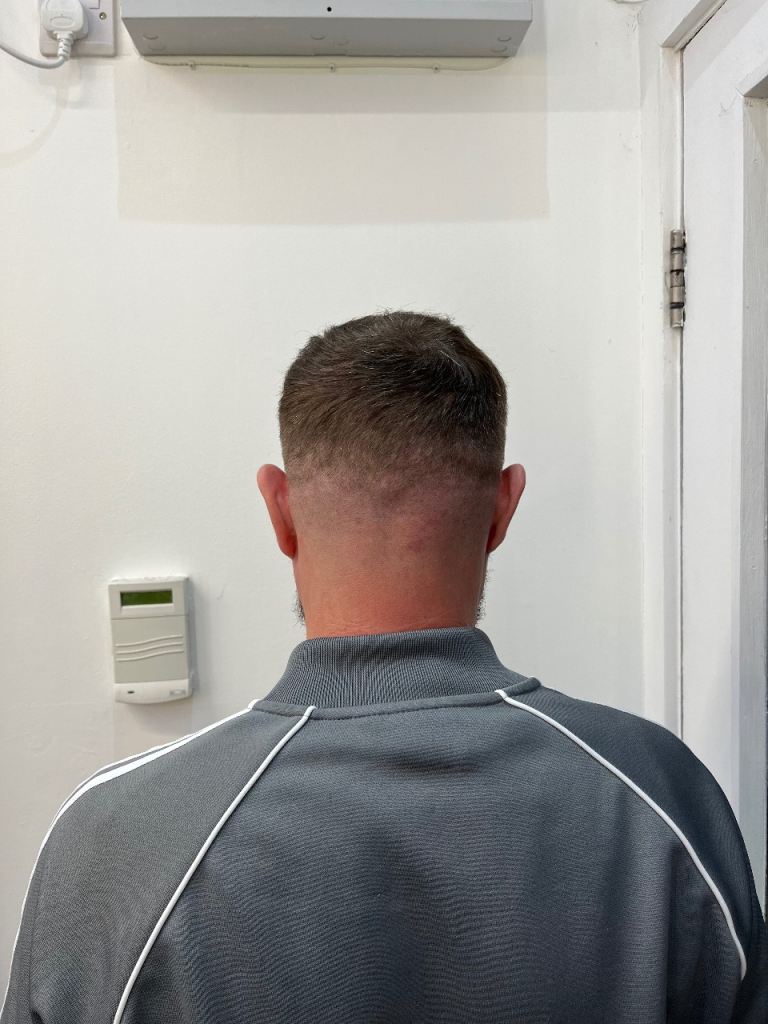 Free skin fade available 