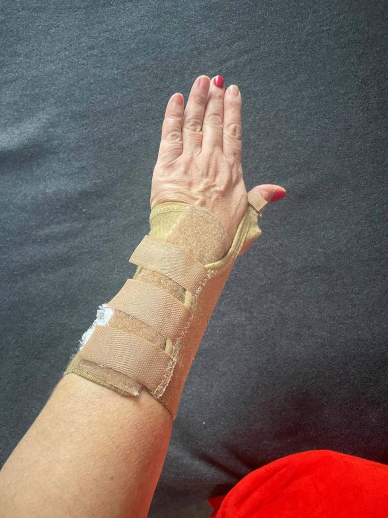 Carpal Tunnel Wrist Support for Arthritis, Tendonitis, Sprains & Injury Relief