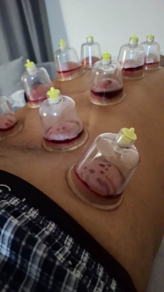 ​Hands-On Hijama Practitioner Bootcamp – London