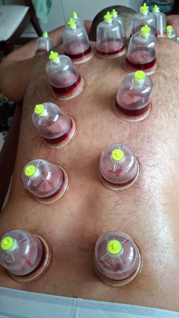 Hijama & Prophetic Medicine Certification Course